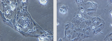 Figure 1: Syncytiotrophoblast layer, 24 hours in culture; 20x