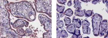 Figure 3: Immunohistochemical localization of ABCA1 and ABCG1 in term placenta. ABCA1 staining, 20x (left panel); ABCG1 staining, 20x (right panel)