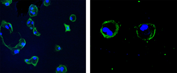 Figure 4: Immunofluorescence staining of ABCA1 in amnion epithelial cells from term, 20x (left panel); and 1st trimester trophoblast cells, 40x (right panel)
