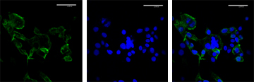 Figure 2: Immunofluorescence staining of ABCA1 (left panel) with Alexa Fluor® 405 conjugated antibody and the nuclear counterstain (middle panel) with DAPI in bovine mammary cells (BME-UV1). Overlay of ABCA1 and DAPI staining (right panel). (Unpublished data)